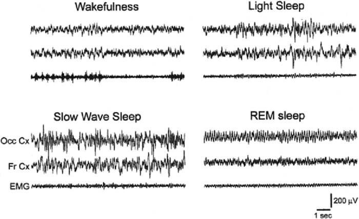 A flat eeg is a good indication of deep sleep