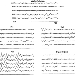 A flat eeg is a good indication of deep sleep