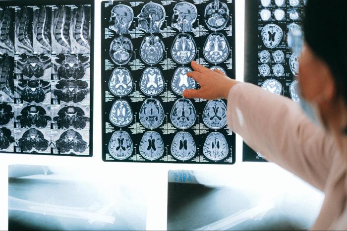 Correctly label the following functional regions of the cerebral cortex